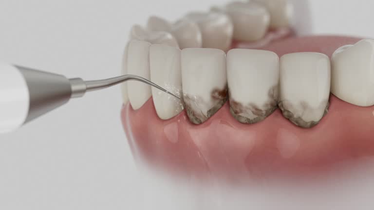 Trusted Tooth Extraction service in Kershaw, SC - Dentist Open Now